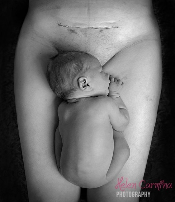 HelenCarminaPhotography-c-section-BC-1-562x650